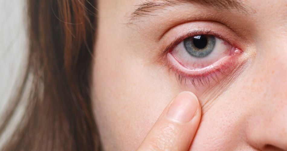 can you get pink eye from a fart