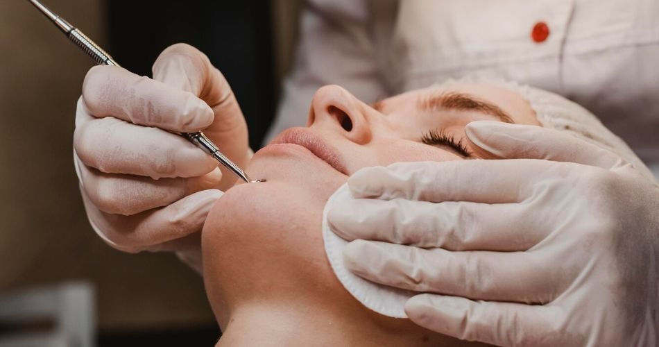 skin peels in mouth