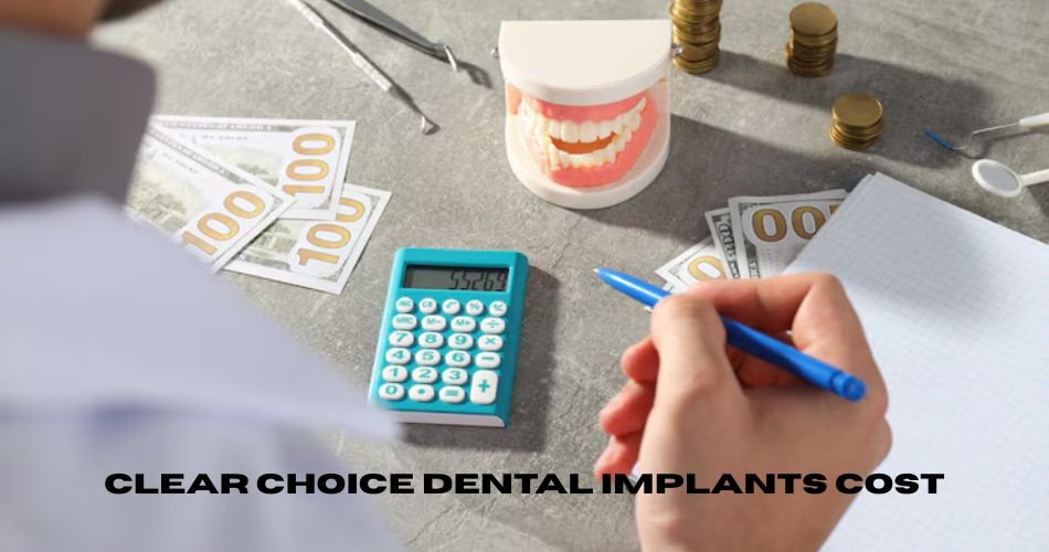 clear choice dental implants cost
