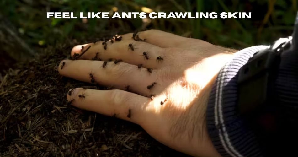 feel like ants crawling skin