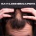 hair loss singapore