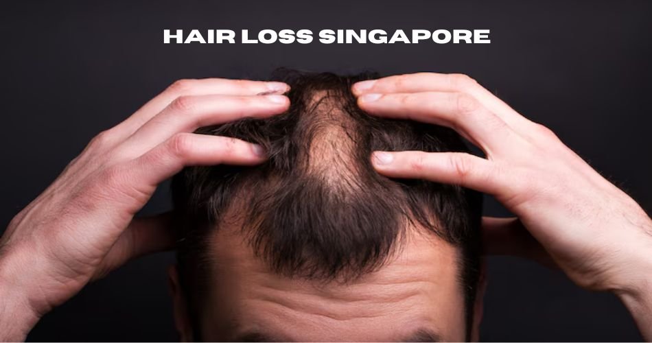 hair loss singapore