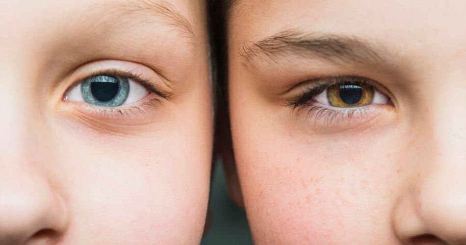 hooded eyes vs normal