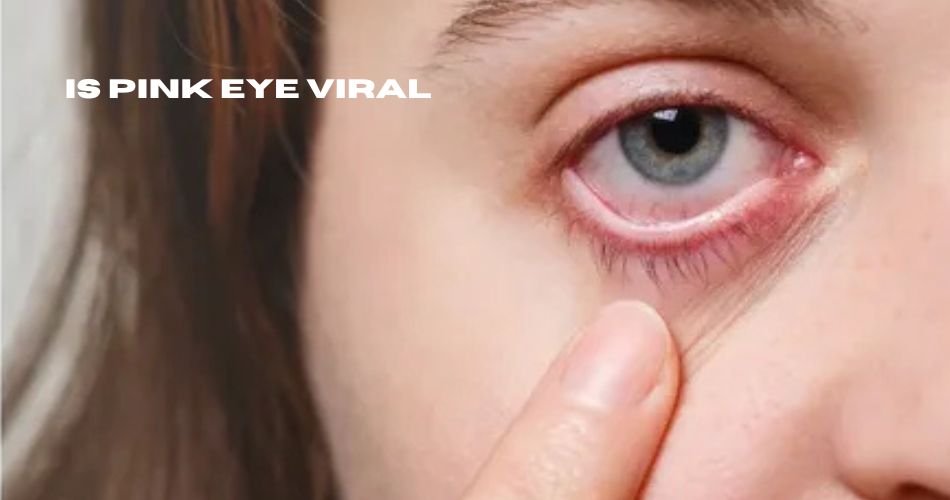 is pink eye viral