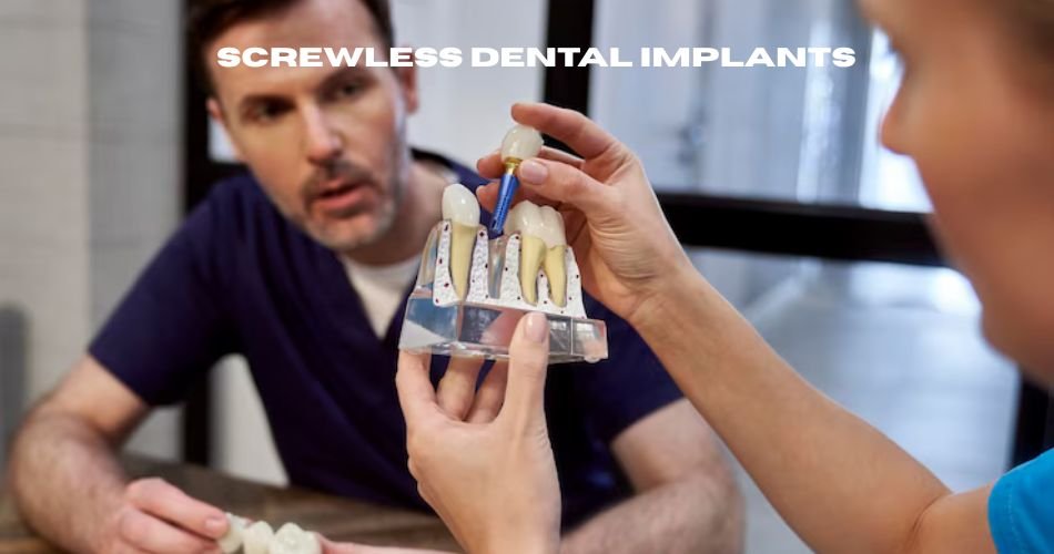 screwless dental implants