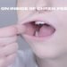 skin on inside of cheek peeling